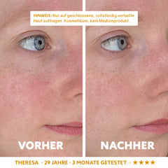 Neuro-Sensitive Skin Serum 'Dermasoothe'