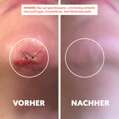 Bio-Narbenöl ‘Pure Repair‘