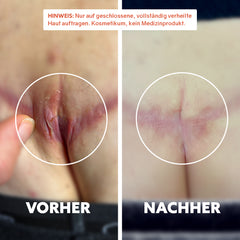 Bio-Narbenöl ‘Pure Repair‘