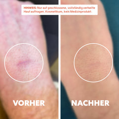 Bio-Narbenöl ‘Pure Repair‘