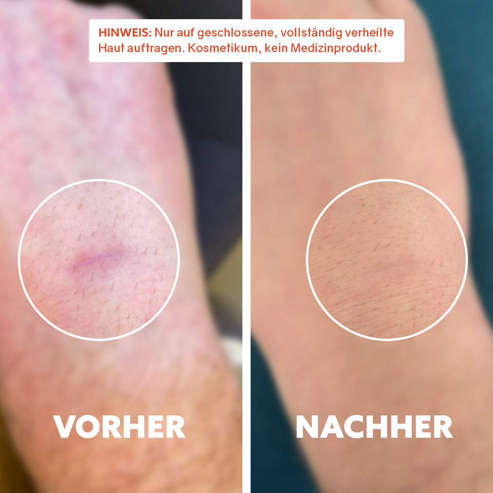 Bio-Narbenöl ‘Pure Repair‘