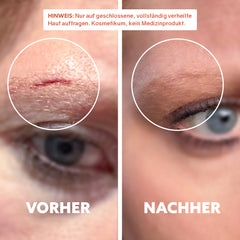 Bio-Narbenöl ‘Pure Repair‘