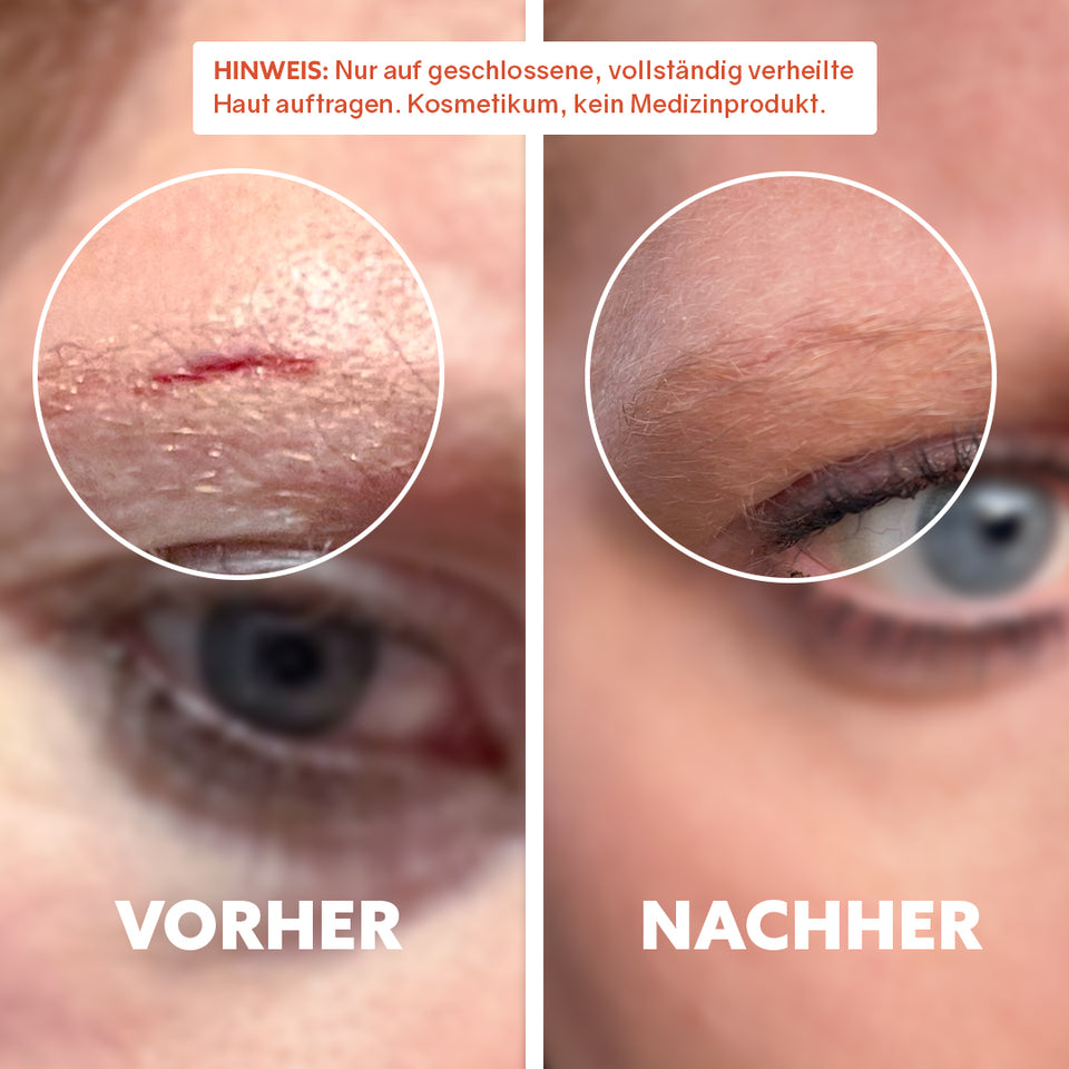 Bio-Narbenöl ‘Pure Repair‘