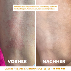 Neuro-Sensitive Skin Serum 'Dermasoothe'