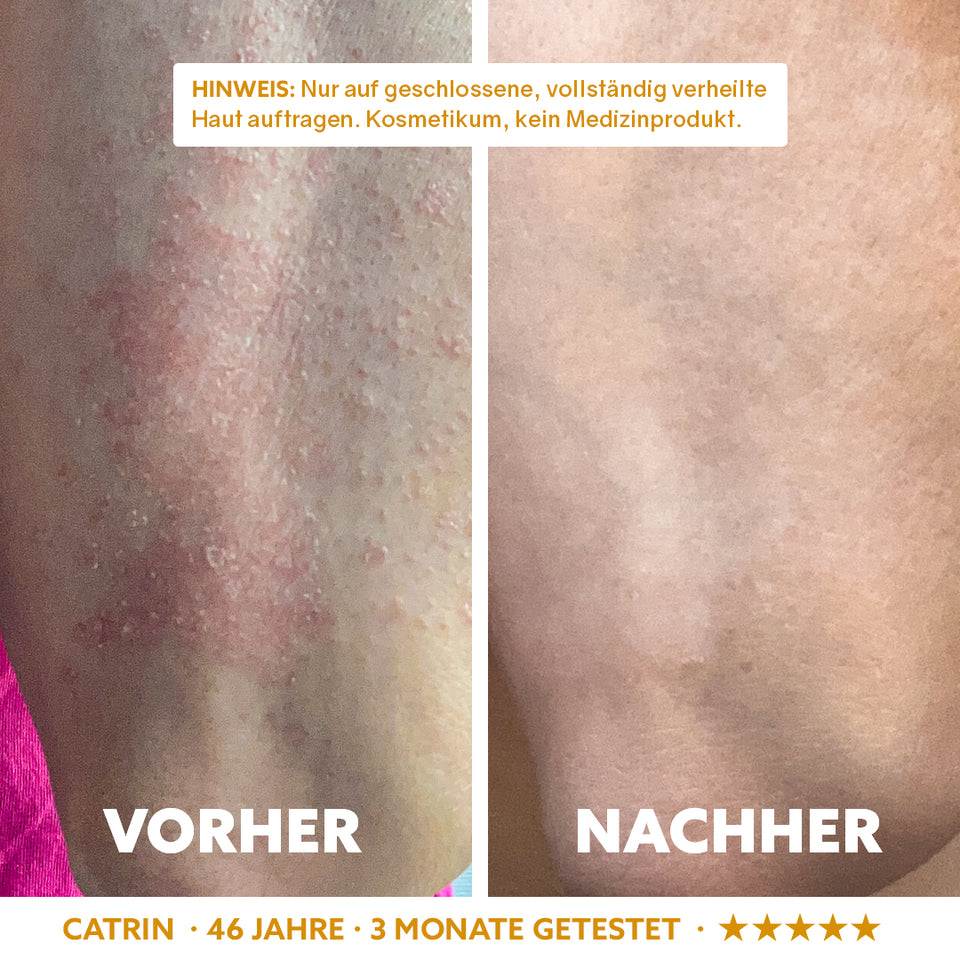 Neuro-Sensitive Skin Serum 'Dermasoothe'