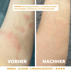 Neuro-Sensitive Skin Serum 'Dermasoothe'
